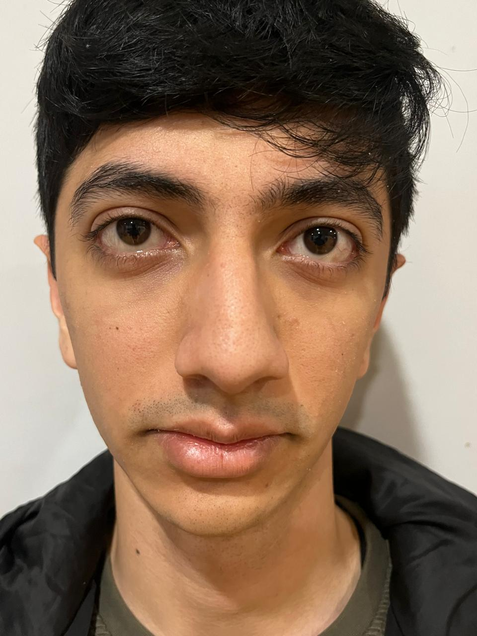 Close-up portrait taken from a short distance